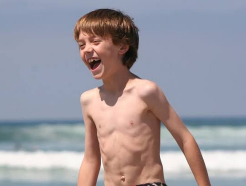 Waspada! Balita Terlalu Kurus Tanda Anak Kurang Gizi, Ini Solusinya