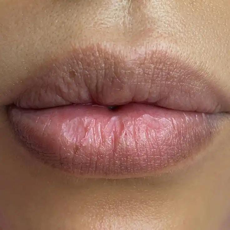 Bibir Gelap Bikin Nggak Pede? Coba Pakai Cara Ini, Hasilnya Bikin Kaget!