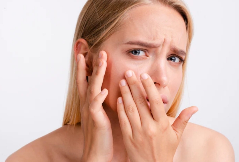 Hati-Hati Ladies! Stres Bikin Kulit Kusam dan Cepat Menua