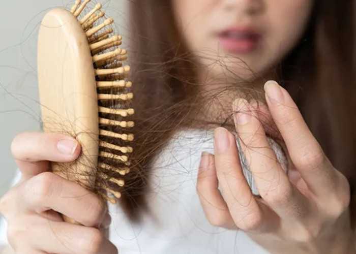 Cara Mengatasi Rambut Rontok Secara Alami dan Efektif, Bisa Dilakukan di Rumah