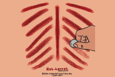 Benarkah Kerokan Bisa Mengatasi Masuk Angin dan Pegal? Ini Penjelasannya!